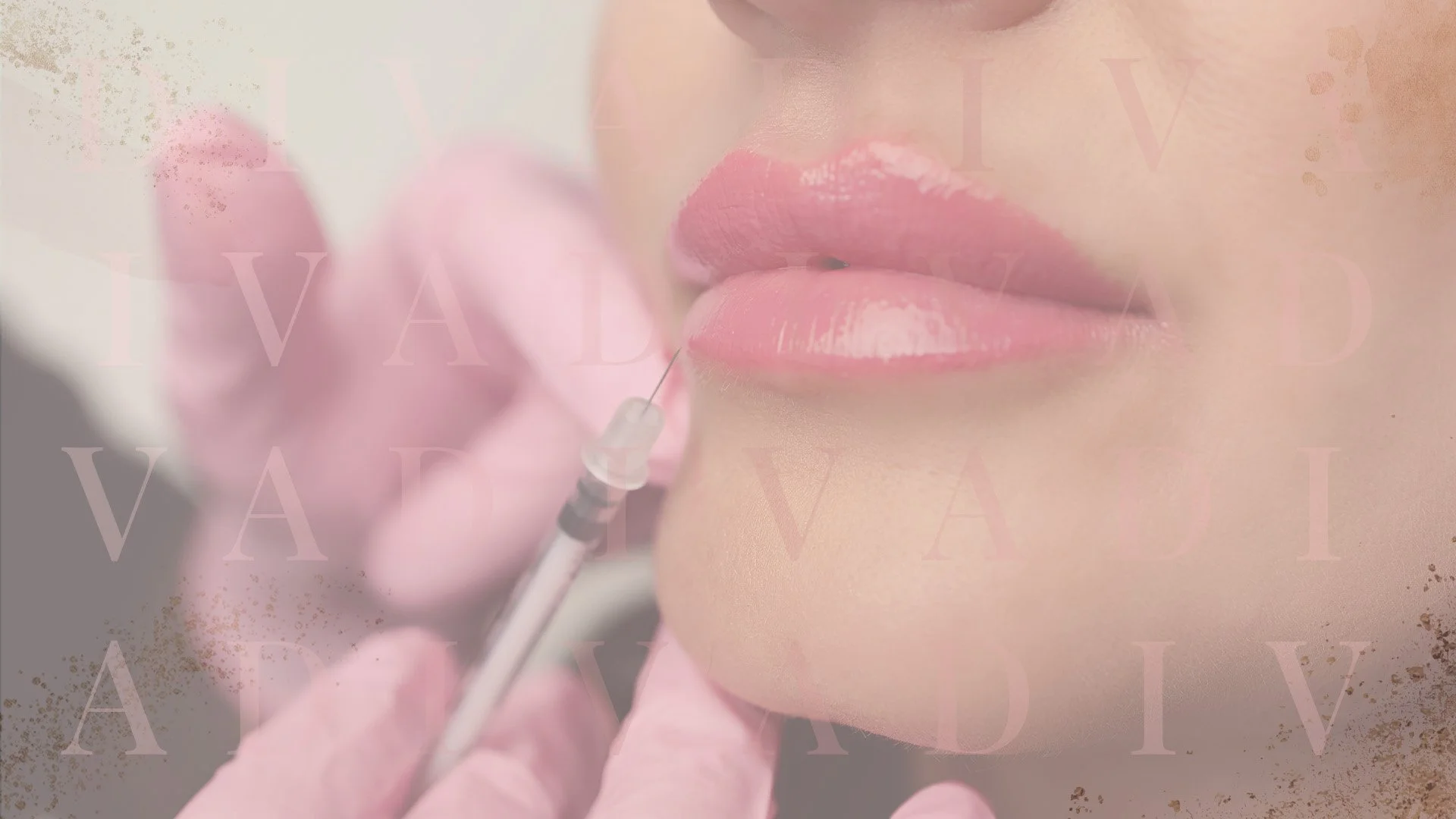 Botox Lip Flip