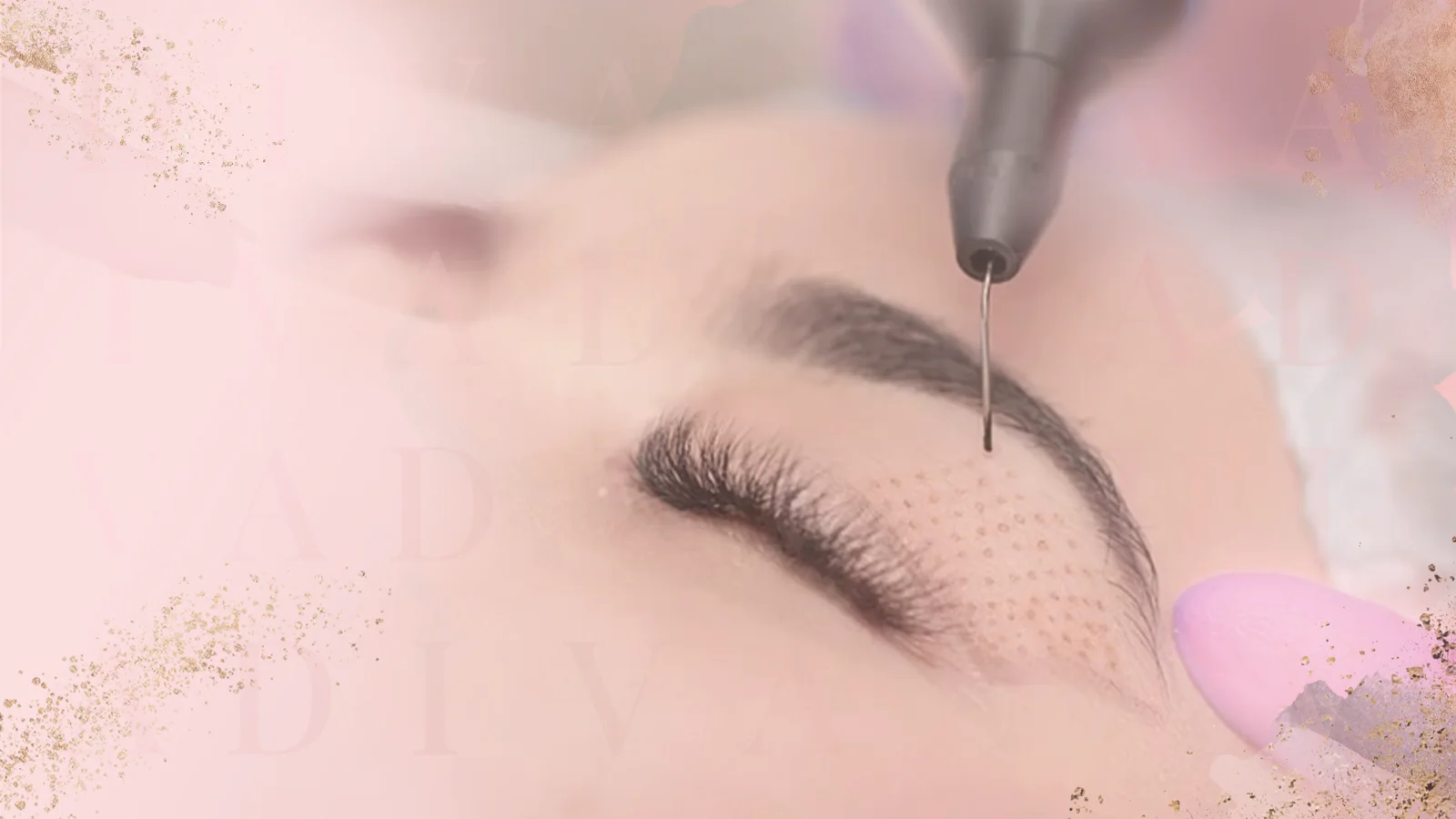 Mole and Skin Tag Removal