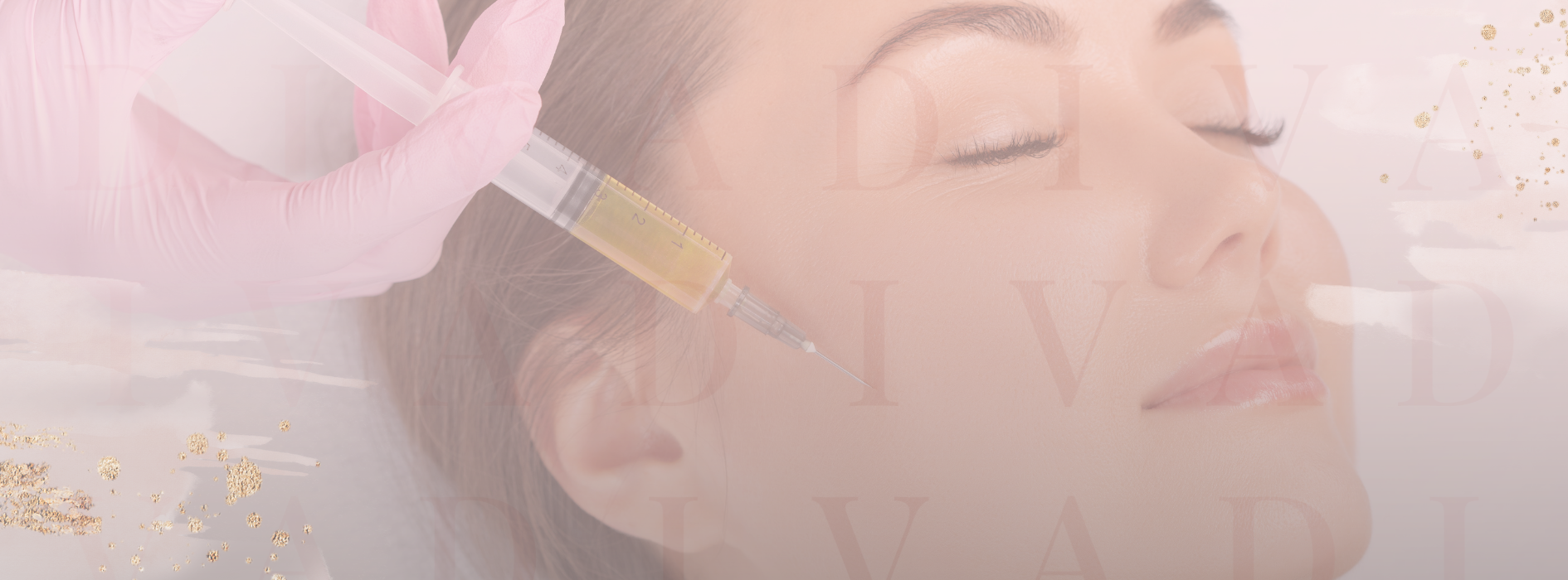 Illustration of platelet-rich plasma treatment at Skin Diva